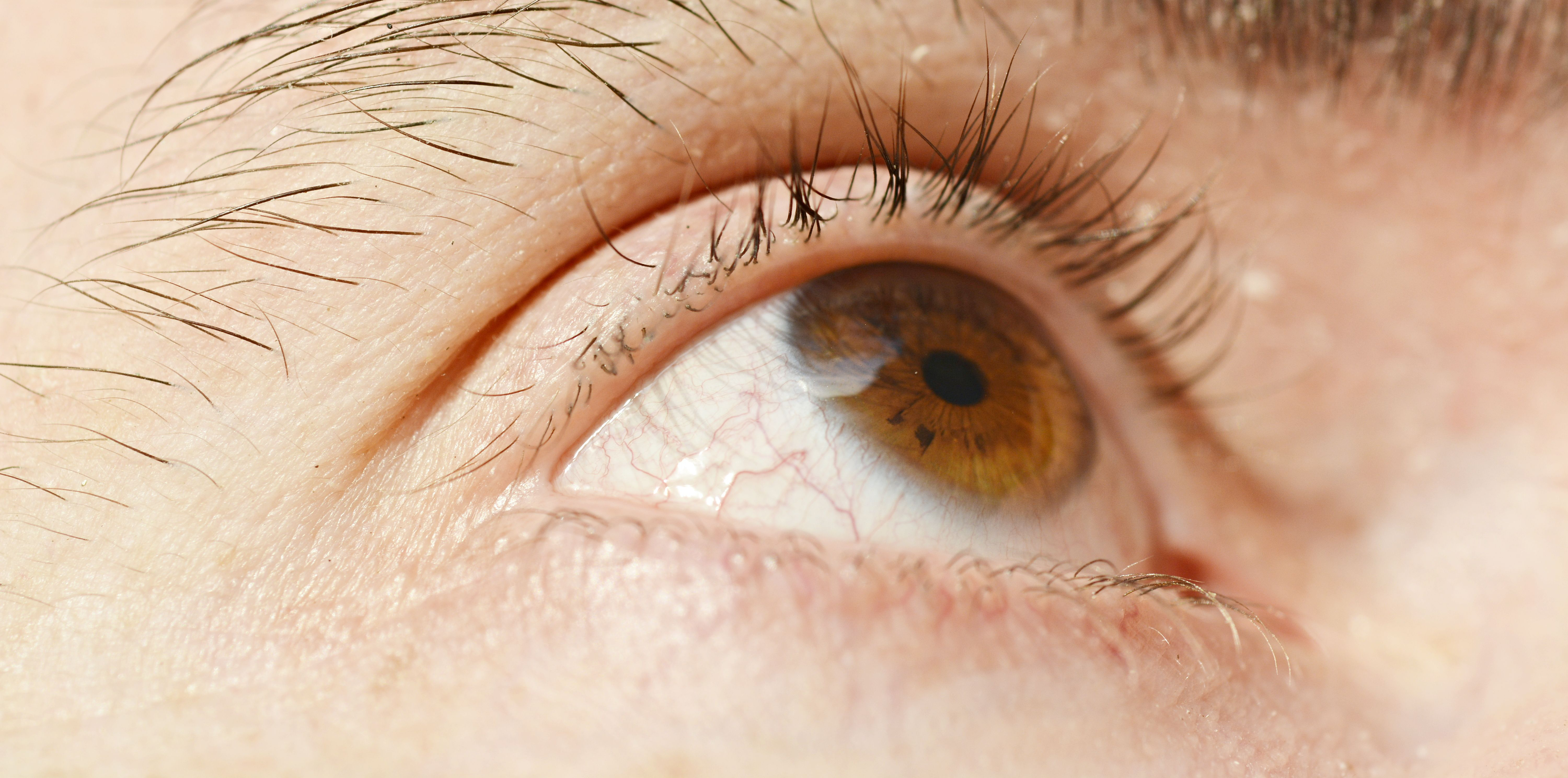 Retina