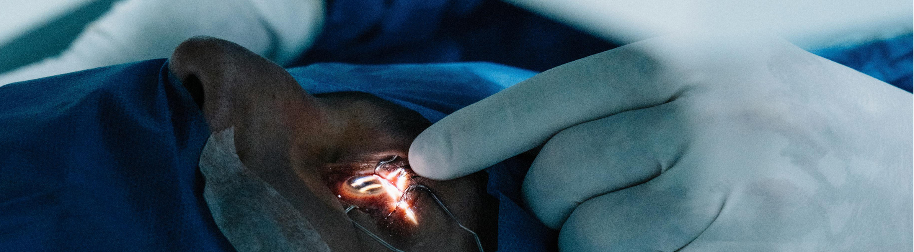 Cirurgia de l'aparell lacrimal